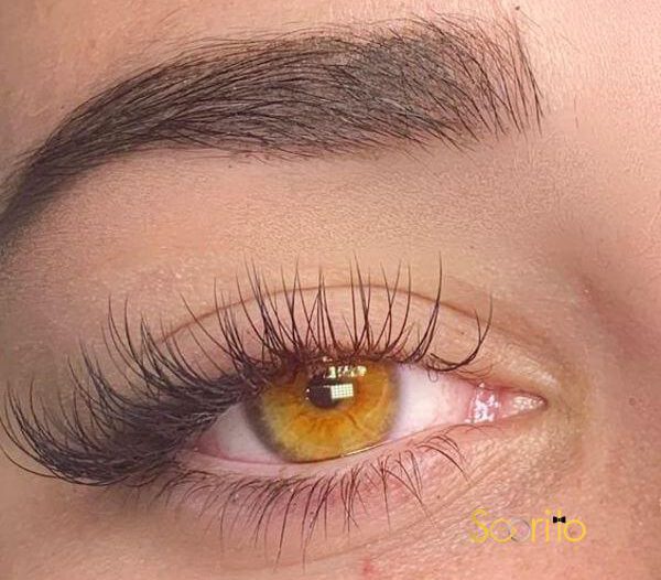 کاشت مژه کلاسیک